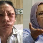 tagar #wajahmuplastik