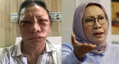 Ratna Sarumpaet Disebut Oplas, Tagar #WajahmuPlastik Jadi Trending Topic