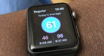Nyawa Pria Ini Terselamatkan Apple Watch