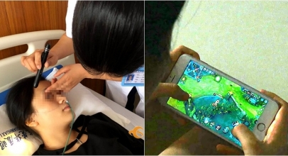 Gara-Gara Kecanduan Main Game, Gadis 21 Tahun Ini Jadi Buta