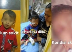 Gara-Gara Kecanduan Gadget, Bocah 3 Tahun Divonis Kanker Darah Stadium 4