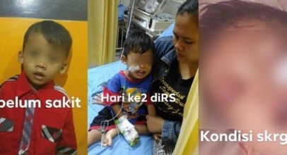 Gara-Gara Kecanduan Gadget, Bocah 3 Tahun Divonis Kanker Darah Stadium 4