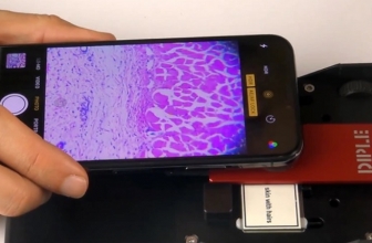 SmartMicroOptic dengan Smartphone Lihat Bakteri