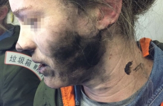 Hati-hati dengan Headphone saat Tidur