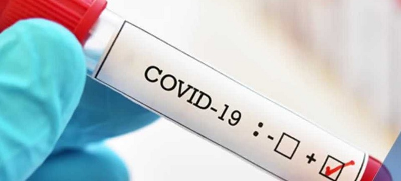 Kominfo Lakukan Langkah Antisipatif Hadapi Covid-19
